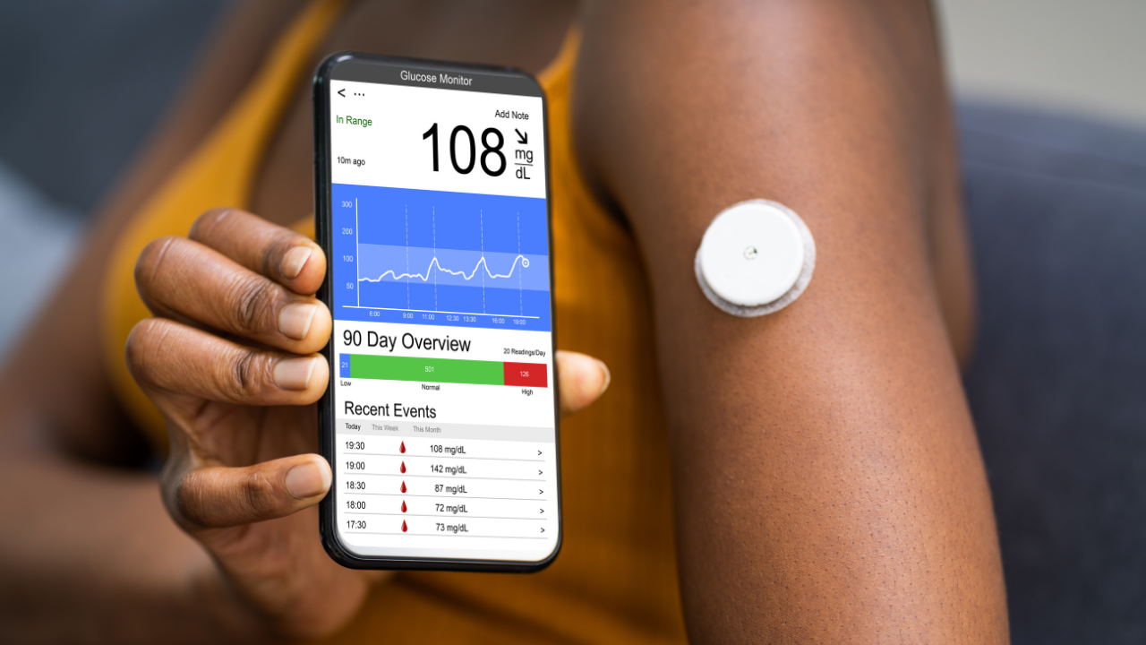 continuous blood glucose monitor